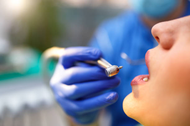 Dental Bonding in Jerome, IL